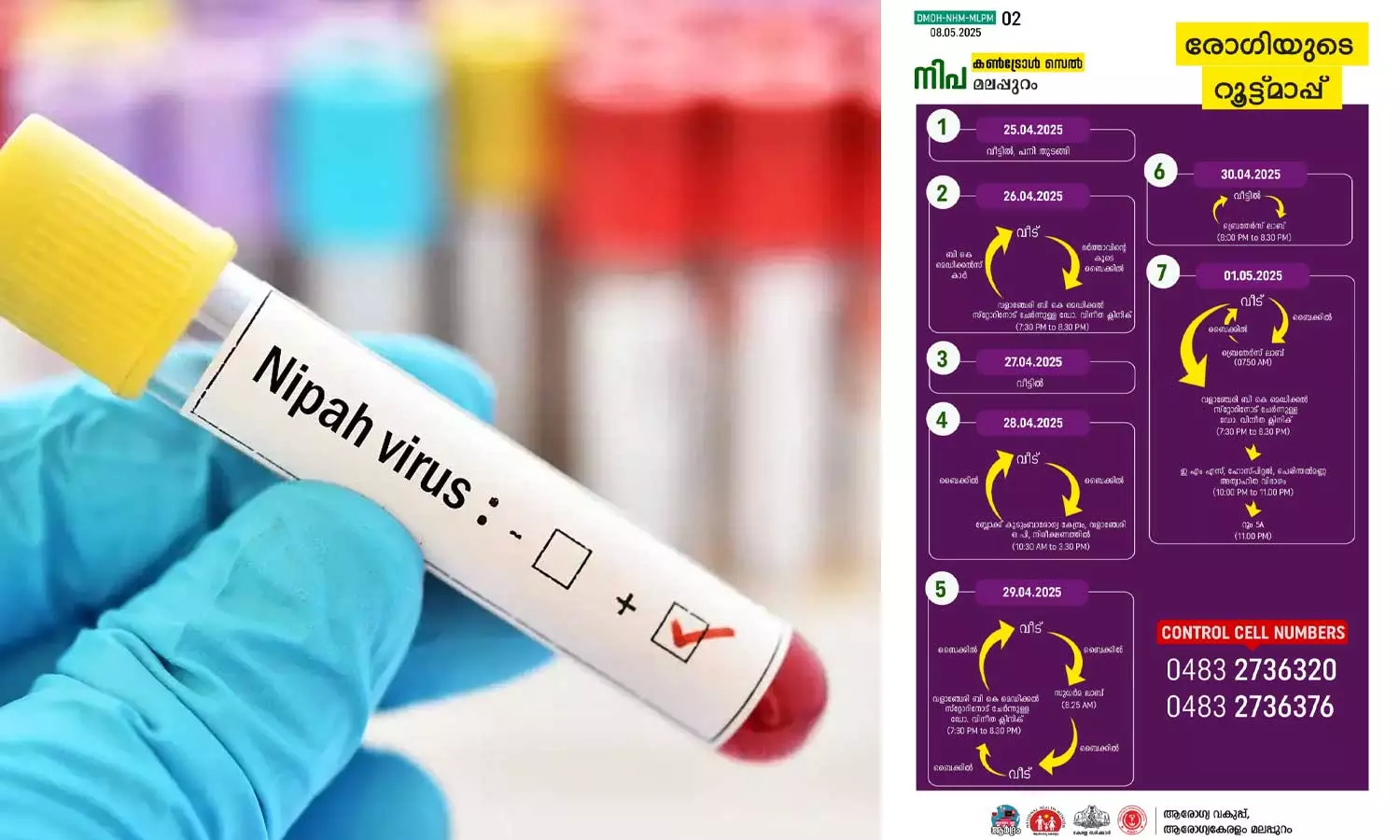 നിപ ബാധിച്ച വളാഞ്ചേരി സ്വദേശിനി ഗുരുതരാവസ്ഥയിൽ; സമ്പർക്കപ്പട്ടികയിൽ 49 പേർ, റൂട്ട്മാപ്പ് പുറത്ത് വിട്ടു നിപ ബാധിച്ച വളാഞ്ചേരി സ്വദേശിനി ഗുരുതരാവസ്ഥയിൽ; സമ്പർക്കപ്പട്ടികയിൽ 49 പേർ, റൂട്ട്മാപ്പ് പുറത്ത് വിട്ടു