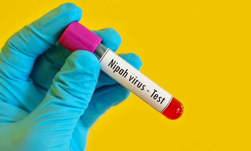 നിപയിൽ ആശ്വാസം; മലപ്പുറത്ത് ആറ് പേരുടെ പരിശോധനാ ഫലം നെഗറ്റീവ്