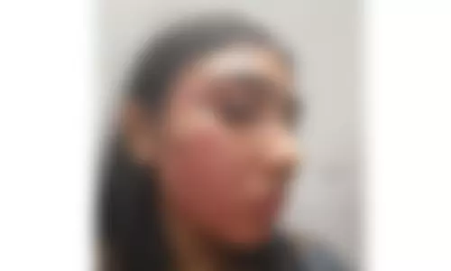 വഞ്ചിയൂർ കോടതിയിൽ ജൂനിയർ അഭിഭാഷകയ്ക്ക് ക്രൂര മർദ്ദനം;സീനിയർ അഭിഭാഷകൻ മോപ്സ്റ്റിക് കൊണ്ട് മർദിച്ചതായി പരാതി