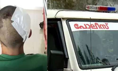 ഫുട്ബോൾ കളിക്കിടെയുണ്ടായ തർക്കം പരിഹരിക്കുന്നതിനിടെ മര്‍ദിച്ചു: 17 കാരന്‍റെ തലയ്ക്ക് ഗുരുതര പരിക്ക്