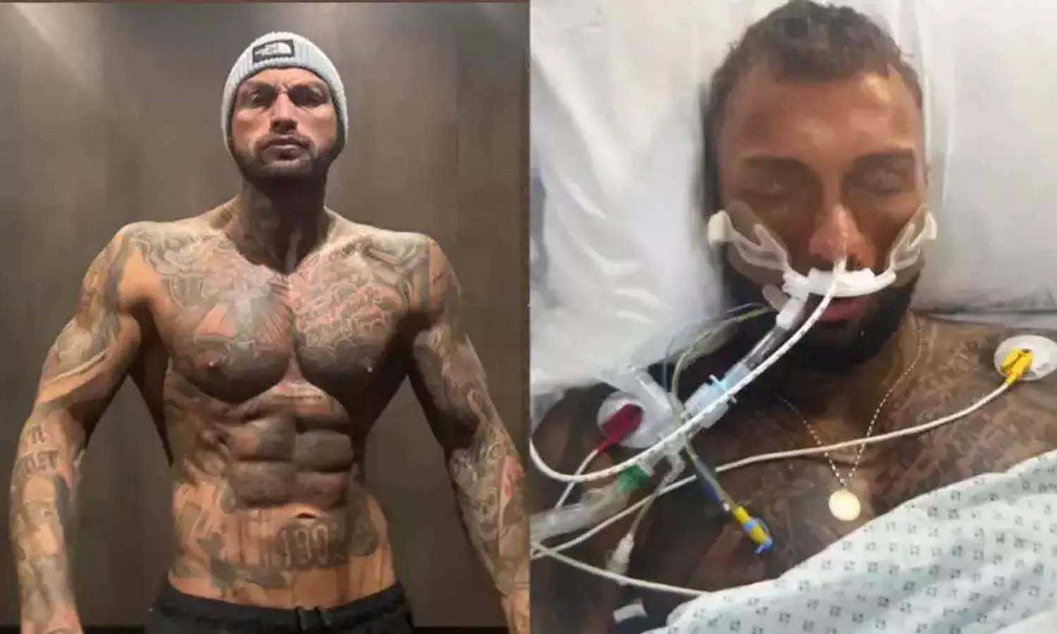 അമിതമായി ഡയറ്റും ഒപ്പം സ്റ്റീറോയിഡും എടുത്തു; ബോഡിബിൽഡർ കോമയിൽ അമിതമായി ഡയറ്റും ഒപ്പം സ്റ്റീറോയിഡും എടുത്തു; ബോഡിബിൽഡർ കോമയിൽ