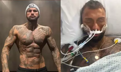 അമിതമായി ഡയറ്റും ഒപ്പം സ്റ്റീറോയിഡും എടുത്തു; ബോഡിബിൽഡർ കോമയിൽ