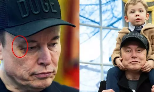 വൈറ്റ് ഹൗസിലെ വിടവാങ്ങൽ ചടങ്ങിന് മസ്ക് എത്തിയത് മുഖത്ത് പാടുമായി; മകൻ ഇടിച്ചതെന്ന് വിശദീകരണം