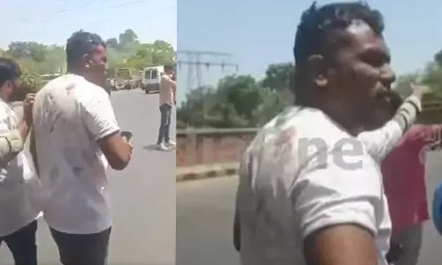 അഹമ്മദാബാദ് വിമാനാപകടത്തിൽ രക്ഷപ്പെട്ട വിശ്വാസ് കുമാർ നടന്നുപോകുന്ന ദൃശ്യങ്ങൾ പുറത്ത്