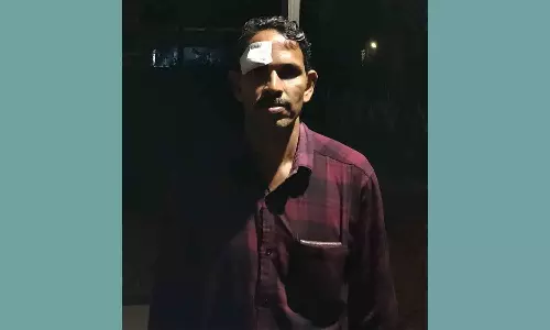 Civil exice office attacked