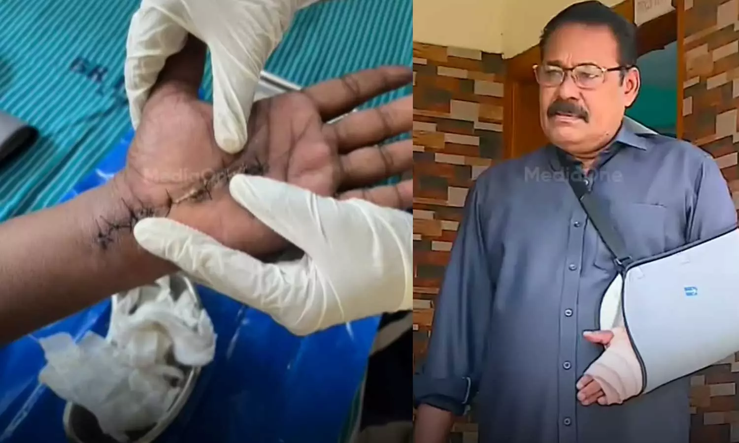 ചികിത്സാ പിഴവ് പരാതി; അഷ്ടമുടി സഹകരണ ആശുപത്രിക്കെതിരെ കേസെടുത്ത് പോലീസ് ചികിത്സാ പിഴവ് പരാതി; അഷ്ടമുടി സഹകരണ ആശുപത്രിക്കെതിരെ കേസെടുത്ത് പോലീസ്