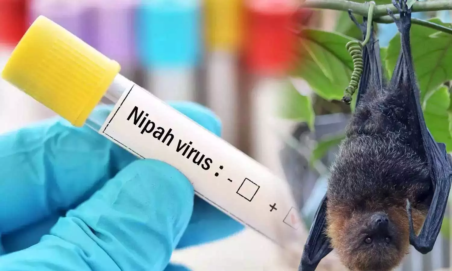 നിപ സമ്പര്ക്കപ്പട്ടികയില് ആകെ 425 പേര്; കൂടുതൽ പേർ മലപ്പുറത്ത് നിപ സമ്പര്ക്കപ്പട്ടികയില് ആകെ 425 പേര്; കൂടുതൽ പേർ മലപ്പുറത്ത്