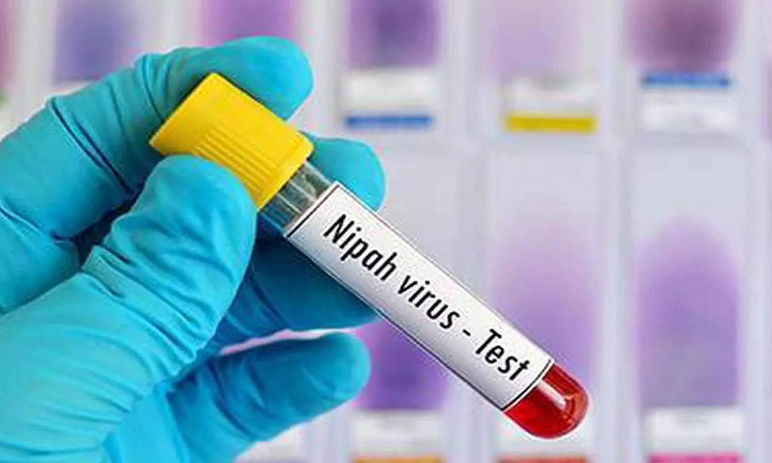 സംസ്ഥാനത്ത് നിപ ഭീതി അകലുന്നു; ഐസൊലേഷനിലുള്ള മൂന്ന് പേരുടെ കൂടി സാമ്പിൾ പരിശോധനാ ഫലം നെഗറ്റീവ് സംസ്ഥാനത്ത് നിപ ഭീതി അകലുന്നു; ഐസൊലേഷനിലുള്ള മൂന്ന് പേരുടെ കൂടി സാമ്പിൾ പരിശോധനാ ഫലം നെഗറ്റീവ്