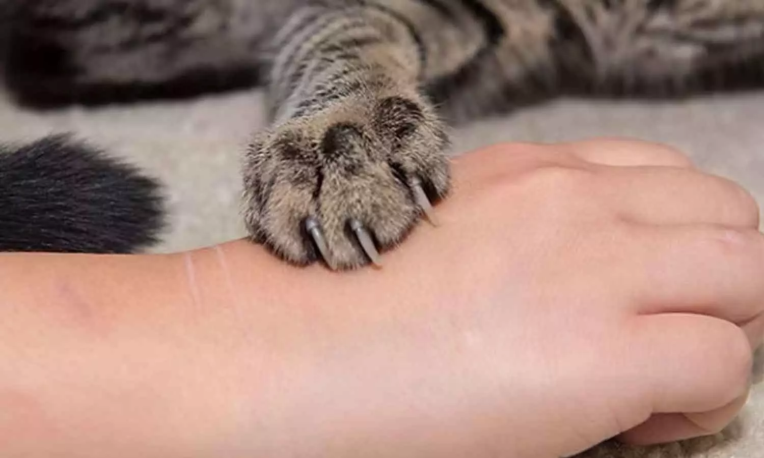 Girl dies after being treated for injuries sustained in attack by pet cat