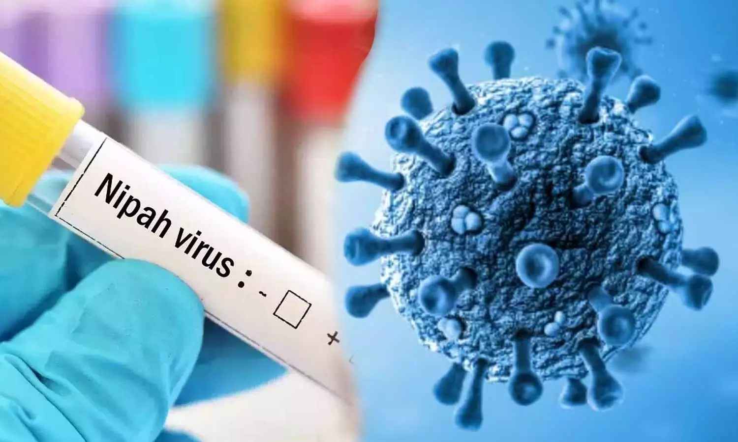 സംസ്ഥാനത്ത് നിപ സമ്പര്ക്കപ്പട്ടികയില് ആകെ 499 പേര് സംസ്ഥാനത്ത് നിപ സമ്പര്ക്കപ്പട്ടികയില് ആകെ 499 പേര്