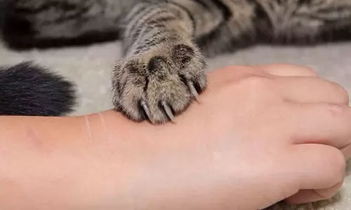 Girl dies after being treated for injuries sustained in attack by pet cat