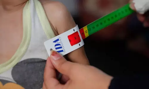 2023 ഒക്ടോബർ മുതൽ ഗസ്സയിൽ 67 കുട്ടികൾ പട്ടിണി കിടന്ന് മരിച്ചതായി റിപ്പോർട്ട്