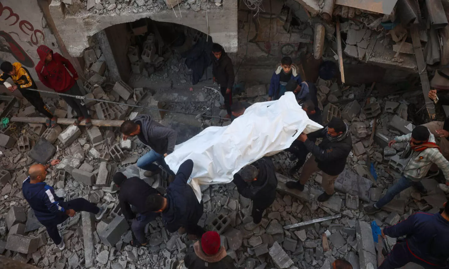 ഇസ്രായേലി ഉപരോധത്തിനും ബോംബാക്രമണത്തിനും ഇടയിൽ ഗസ്സയിൽ ഗില്ലൻ-ബാരെ സിൻഡ്രോം ബാധിച്ച് മൂന്ന് പേർ മരിച്ചു