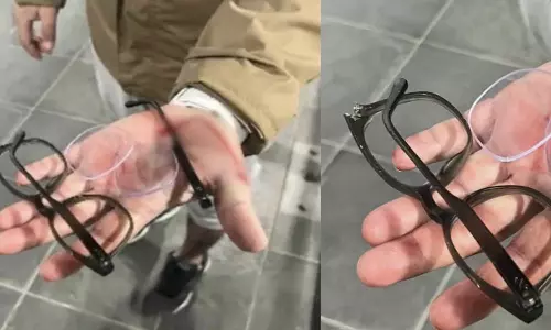 കണ്ണട വലിച്ചുപൊട്ടിച്ചു, മുഖമിടിച്ചു തകർത്തു; അയര്‍ലന്‍ഡില്‍ വംശീയാതിക്രമം നേരിട്ടതായി ഇന്ത്യൻ വംശജന്‍