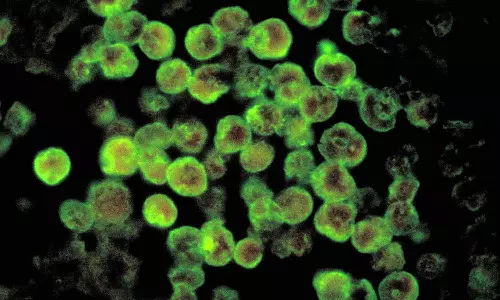 കോഴിക്കോട് രണ്ടുപേർക്ക് കൂടി അമീബിക് മസ്തിഷ്‌ക ജ്വരം സ്ഥിരീകരിച്ചു