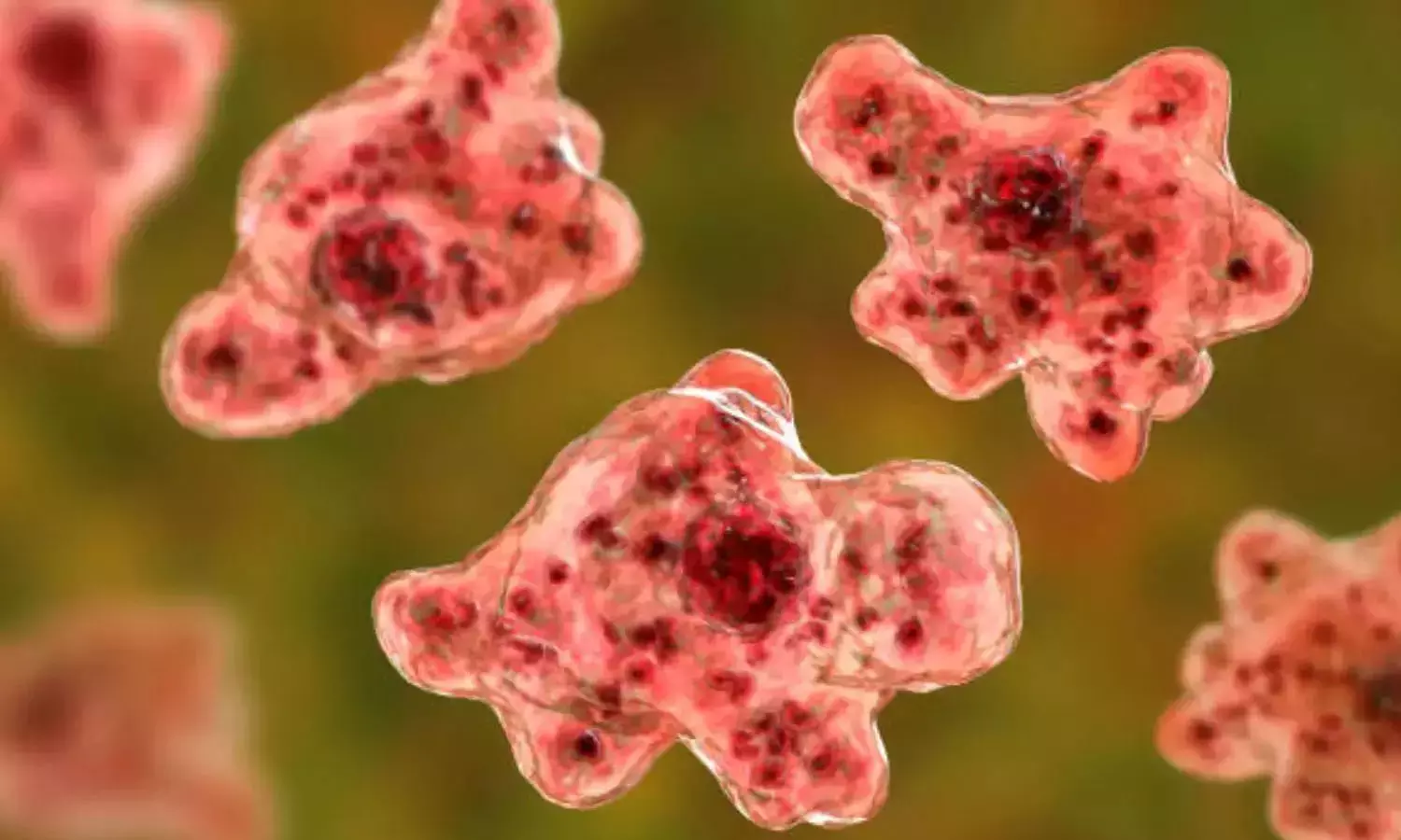 സംസ്ഥാനത്ത് വീണ്ടും അമീബിക് മസ്തിഷ്കജ്വരം; 11 വയസുകാരിക്ക് രോഗം സ്ഥിരീകരിച്ചു സംസ്ഥാനത്ത് വീണ്ടും അമീബിക് മസ്തിഷ്കജ്വരം; 11 വയസുകാരിക്ക് രോഗം സ്ഥിരീകരിച്ചു