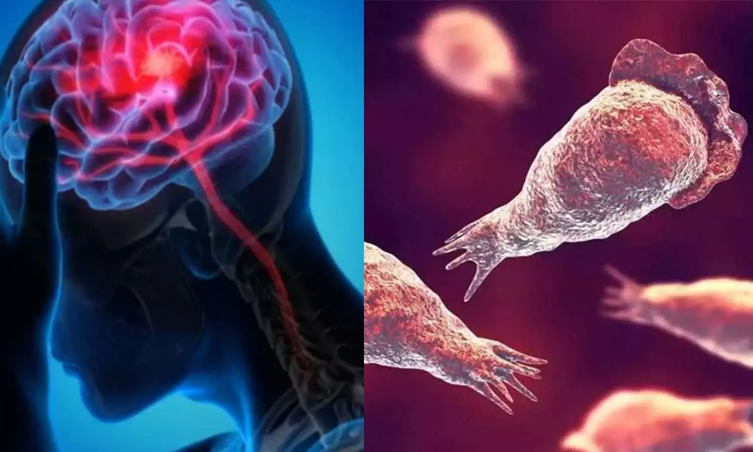 പ്രതിരോധിക്കാം അമീബിക് മസ്തിഷ്‌ക ജ്വരത്തെ; വേണം ജാഗ്രത