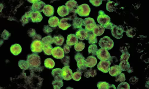 സംസ്ഥാനത്ത് ഒരാൾക്ക് കൂടി അമീബിക് മസ്തിഷ്‌ക ജ്വരം സ്ഥിരീകരിച്ചു