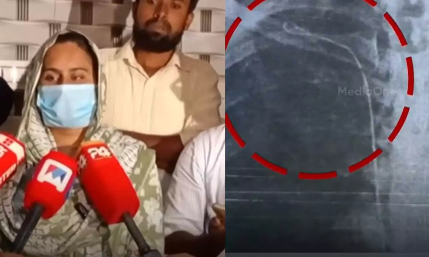 ശസ്ത്രക്രിയക്കിടെ ഗൈഡ് വയർ നെഞ്ചില്‍ കുടുങ്ങിയ സംഭവം: ആശുപത്രി രേഖകൾ  ആവശ്യപ്പെട്ട് പൊലീസ്