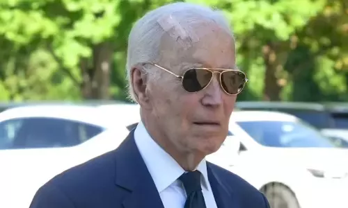 തലയില് വലിയ മുറിവുമായി മുൻ അമേരിക്കൻ പ്രസിഡന്റ് ജോ ബൈഡന്; സ്കിന് കാന്സര് ശസ്ത്രക്രിയ നടന്നതായി റിപ്പോർട്ട് തലയില് വലിയ മുറിവുമായി മുൻ അമേരിക്കൻ പ്രസിഡന്റ് ജോ ബൈഡന്; സ്കിന് കാന്സര് ശസ്ത്രക്രിയ നടന്നതായി റിപ്പോർട്ട്