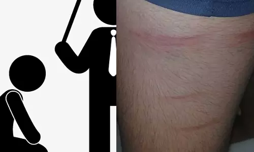 അവധിയെടുത്തതിന് വിദ്യാര്‍ഥിക്ക് ക്രൂരമര്‍ദനം; അധ്യാപകനെതിരെ പരാതി