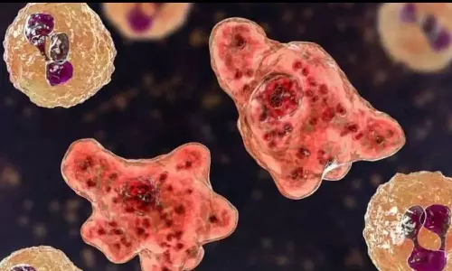 amoebic meningoencephalitis,kerala,kozhikode medical college,kozhikode,amoebic meningoencephalitiskerala,latest malayalam news