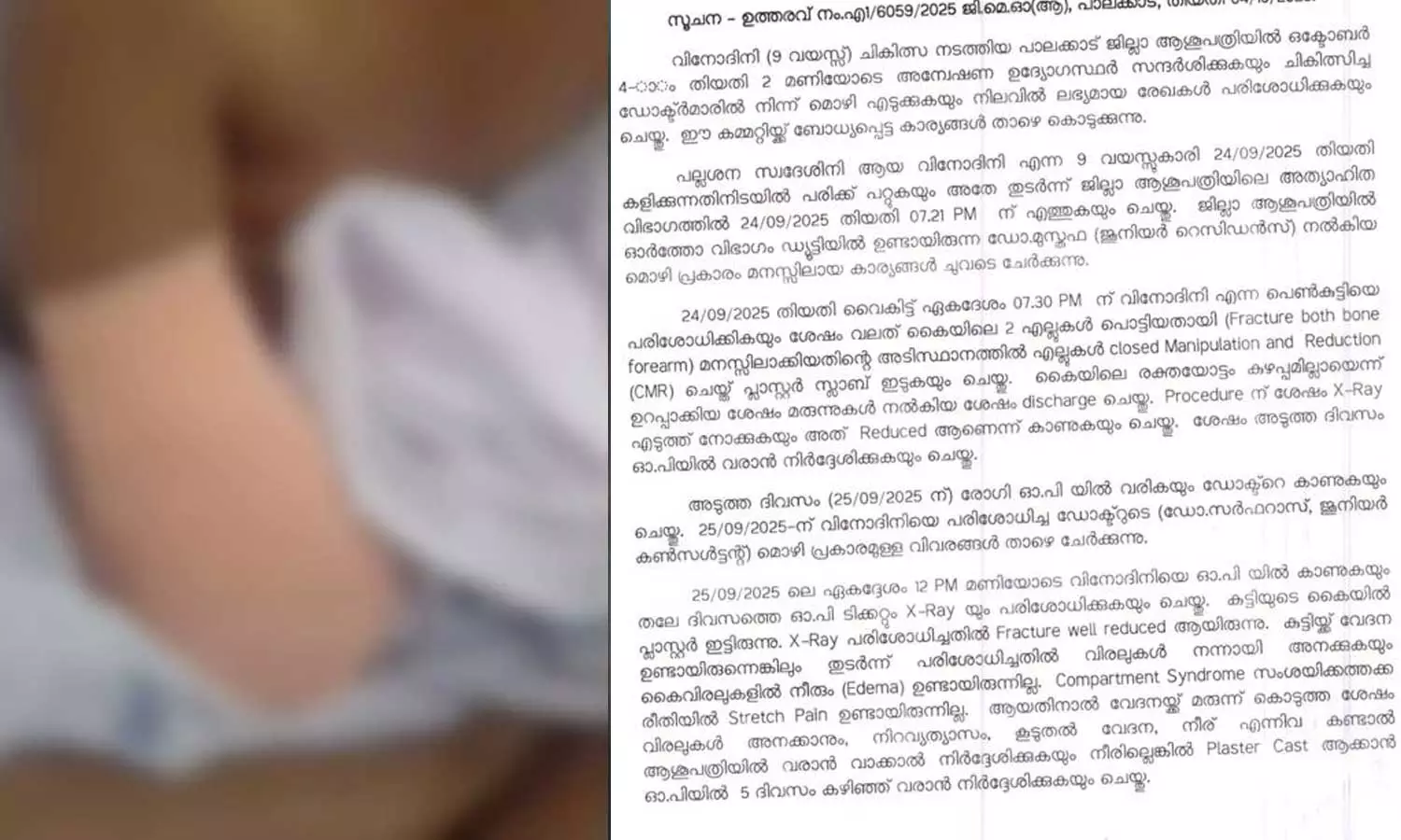 ഒമ്പതുകാരിയുടെ കൈമുറിച്ചുമാറ്റിയ സംഭവം: ഡോക്ടർമാരുടെ പിഴവ് പരാമർശിക്കാതെ അന്വേഷണ റിപ്പോർട്ട് ഒമ്പതുകാരിയുടെ കൈമുറിച്ചുമാറ്റിയ സംഭവം: ഡോക്ടർമാരുടെ പിഴവ് പരാമർശിക്കാതെ അന്വേഷണ റിപ്പോർട്ട്