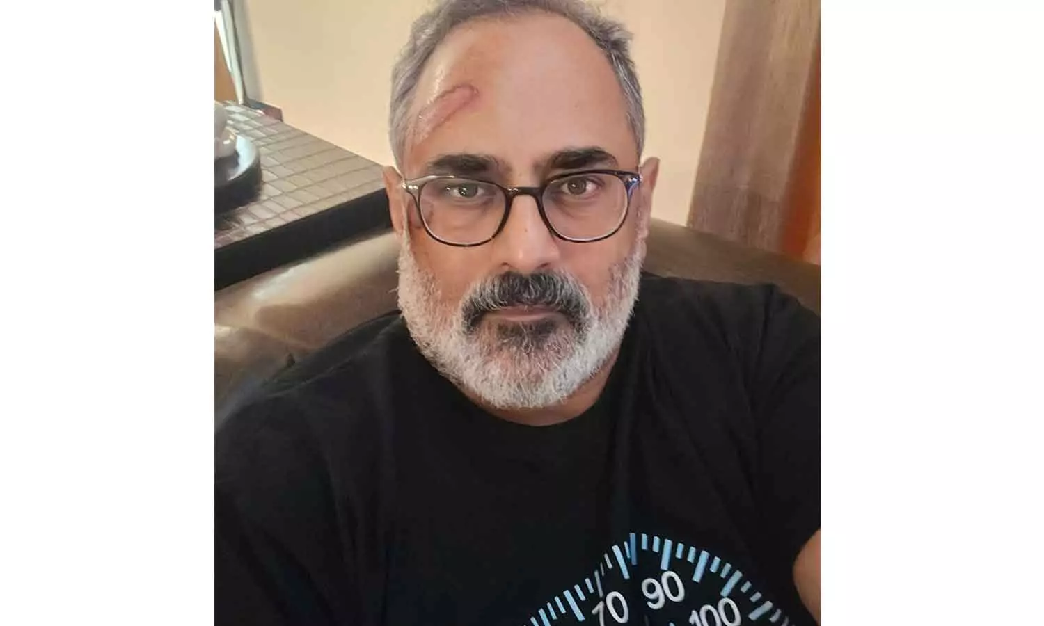 ‘തെല്ല് വേദനയോടെയാണെങ്കിലും വിലപ്പെട്ട ആ പാഠം പഠിക്കാന്‍ കഴിഞ്ഞു’; ട്രെഡ്മില്ലില്‍ നിന്ന് വീണ് രാജീവ് ചന്ദ്രശേഖര്‍