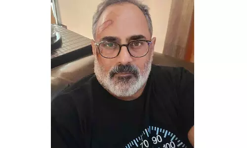 ‘തെല്ല് വേദനയോടെയാണെങ്കിലും വിലപ്പെട്ട ആ പാഠം പഠിക്കാന് കഴിഞ്ഞു’; ട്രെഡ്മില്ലില് നിന്ന് വീണ് രാജീവ് ചന്ദ്രശേഖര് ‘തെല്ല് വേദനയോടെയാണെങ്കിലും വിലപ്പെട്ട ആ പാഠം പഠിക്കാന് കഴിഞ്ഞു’; ട്രെഡ്മില്ലില് നിന്ന് വീണ് രാജീവ് ചന്ദ്രശേഖര്