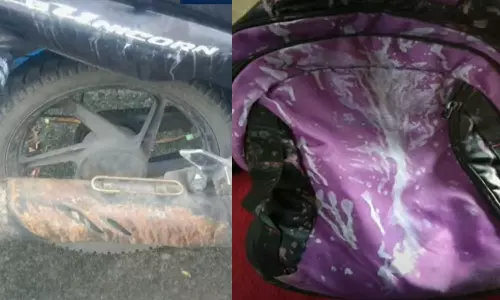 തേവരയിൽ ടാങ്കർ ലോറിയിൽ നിന്ന്  സൾഫൂരിക് ആസിഡ് തെറിച്ച് വീണ് ബൈക്ക് യാത്രികന് ഗുരുതര പൊള്ളല്‍