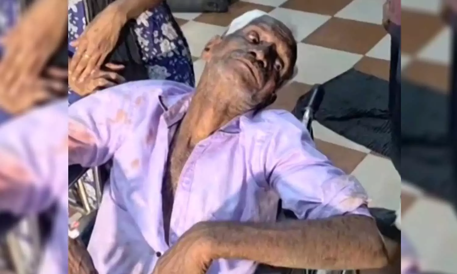 വഴി അടച്ചതുമായി ബന്ധപ്പെട്ട തർക്കം;കോഴിക്കോട് കോടഞ്ചേരിയിൽ വയോധികന്  അയൽവാസിയുടെ ക്രൂരമർദനം