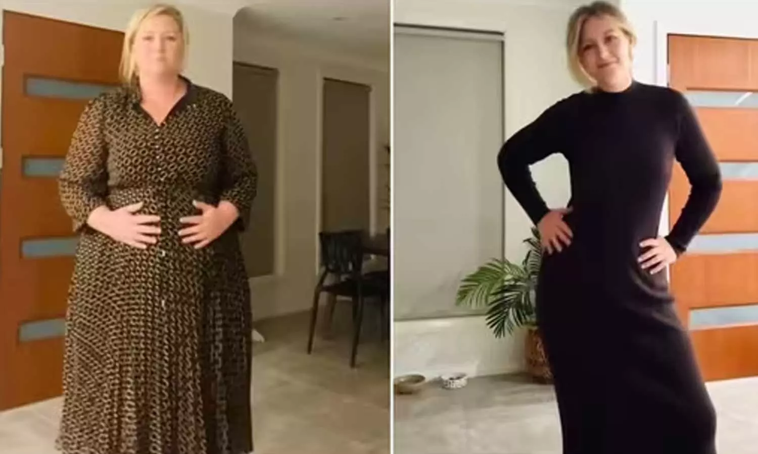 കുറച്ചത് 70 കിലോ ഭാരം; ഭക്ഷണം ഒഴിവാക്കുന്നതിനെക്കാൾ പ്രധാനം മനസ്സിന്, അനുഭവം പങ്കുവെച്ച് യുവതി