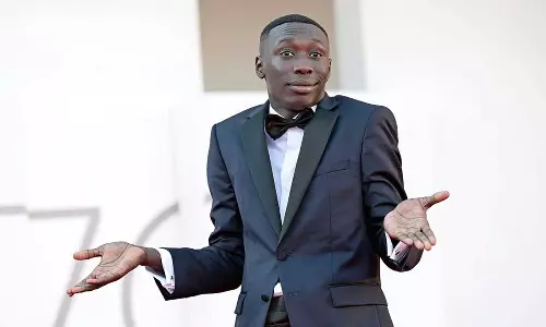 ഖാബി ലാമിന് വാഹനാപകടം? സോഷ്യൽ മീഡിയ താരത്തിന് സംഭവിച്ചത്?| Fact Check