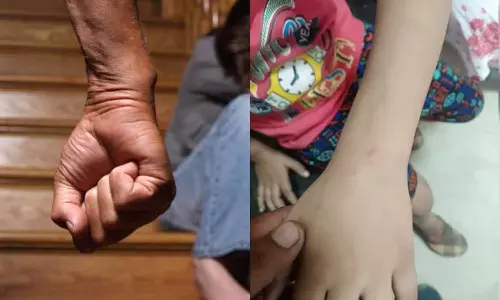 Man Makes Pet Dog Attack Child After Guava Falls In His Courtyard in UP