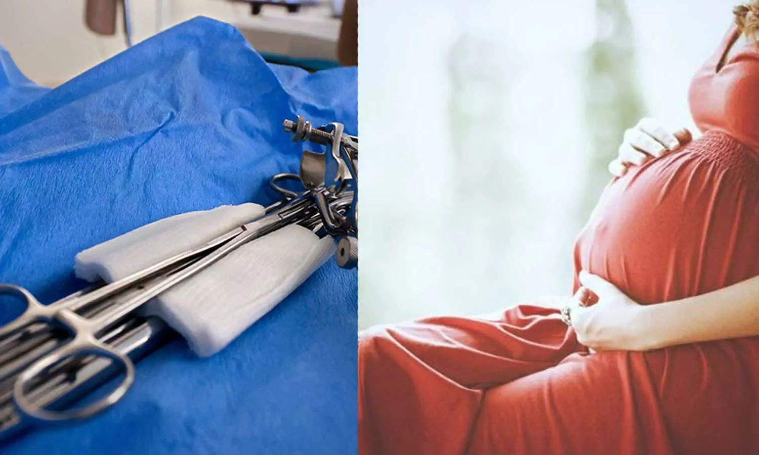 പ്രസവ ശസ്ത്രക്രിയക്കിടെ ബാന്‍ഡേജ് വയറ്റില്‍ തുന്നിക്കെട്ടി; അണുബാധയേറ്റ് 26കാരിക്ക് ദാരുണാന്ത്യം