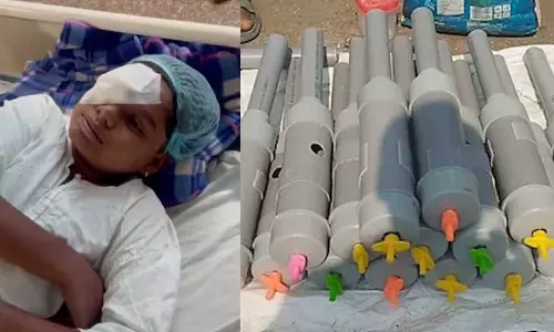 ദീപാവലി ആഘോഷം; കാർബൈഡ് ഗൺ പൊട്ടിച്ച 14 കുട്ടികൾക്ക് കാഴ്‌ച നഷ്ടമായി