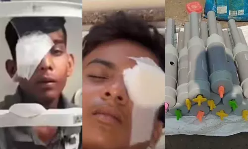 what are carbide guns diwali celebrations leave 300 injured in MP