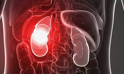 വൃക്കരോഗം നിസാരമല്ല; അവഗണിക്കാന്‍ പാടില്ലാത്ത പ്രാരംഭ ലക്ഷണങ്ങള്‍