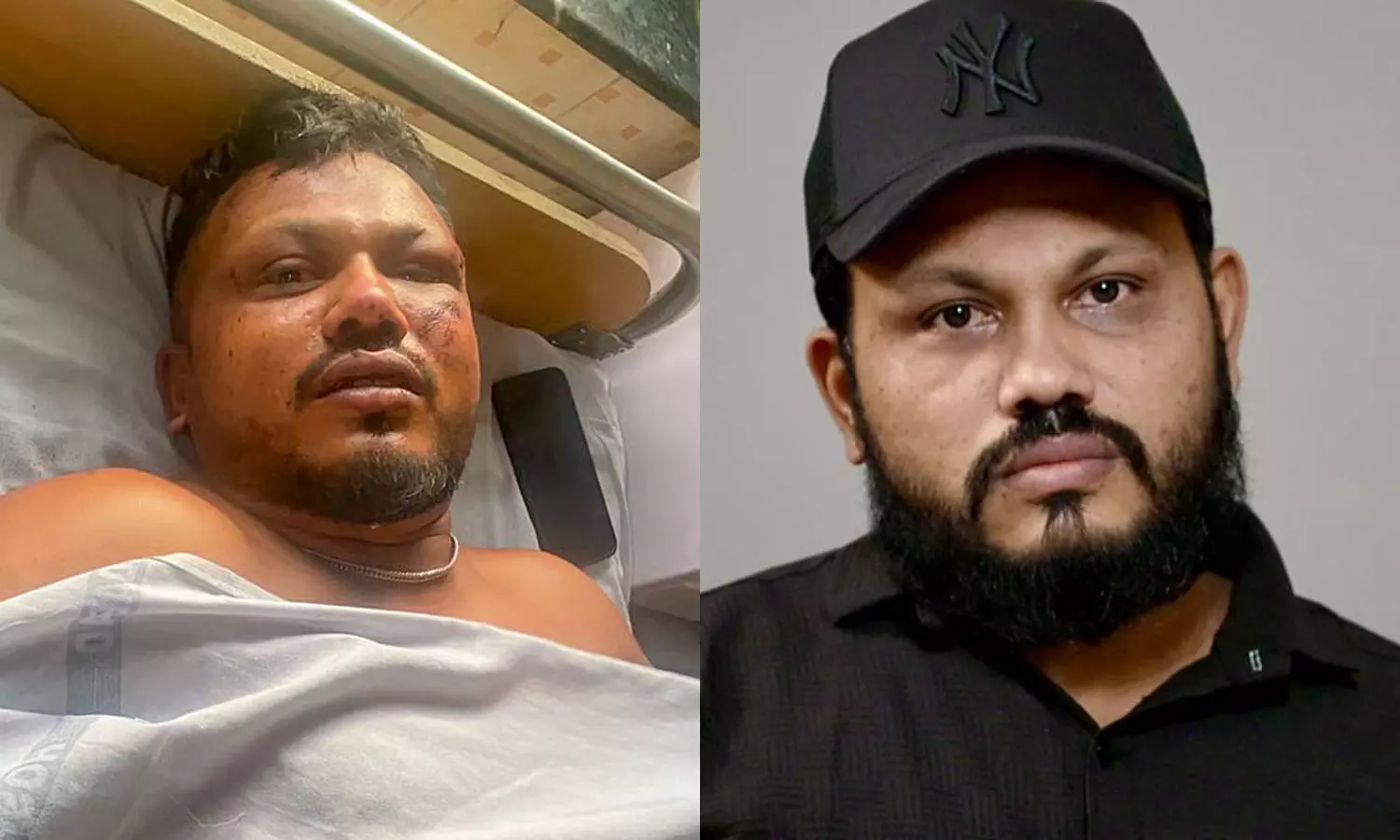 Lost and broken, not talking to family Says Lone Air India crash survivors anguish