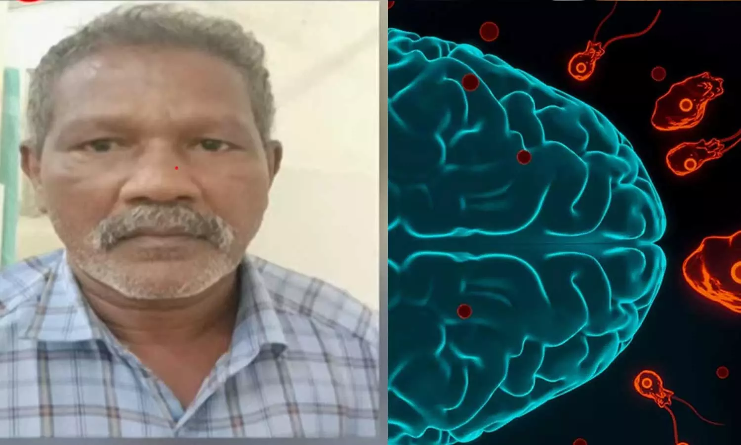 വീണ്ടും അമീബിക് മസ്തിഷ്കജ്വര മരണം; മരിച്ചത് ആറ്റിങ്ങൽ സ്വദേശി വീണ്ടും അമീബിക് മസ്തിഷ്കജ്വര മരണം; മരിച്ചത് ആറ്റിങ്ങൽ സ്വദേശി