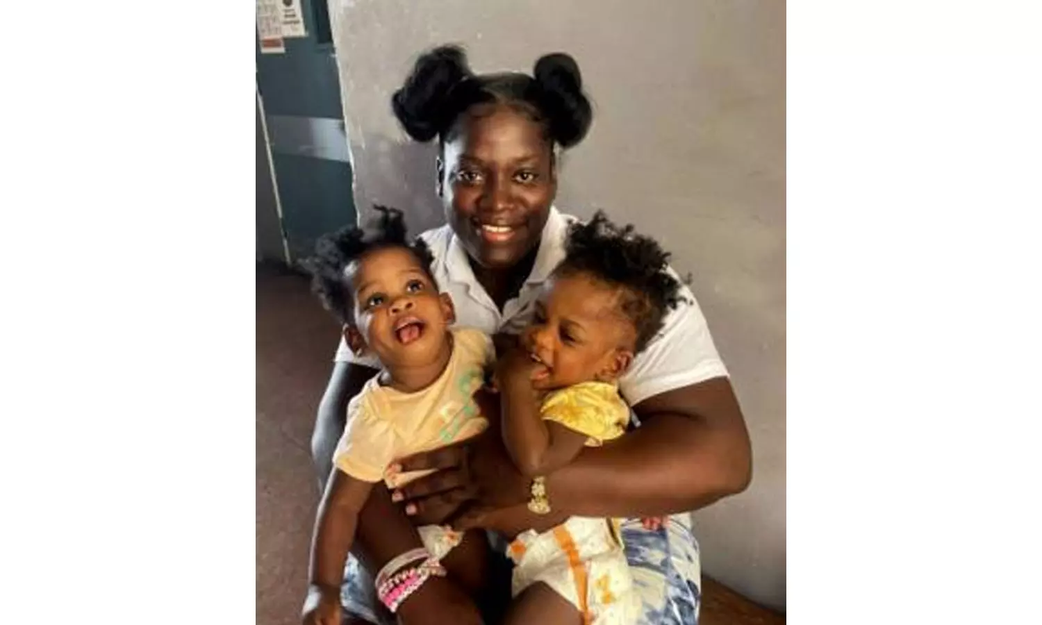 റിയാദിൽ വെച്ച് നടന്ന ജമൈക്കൻ സയാമീസ് ഇരട്ടകളുടെ വേർതിരിക്കൽ ശസ്ത്രക്രിയ വിജയകരം