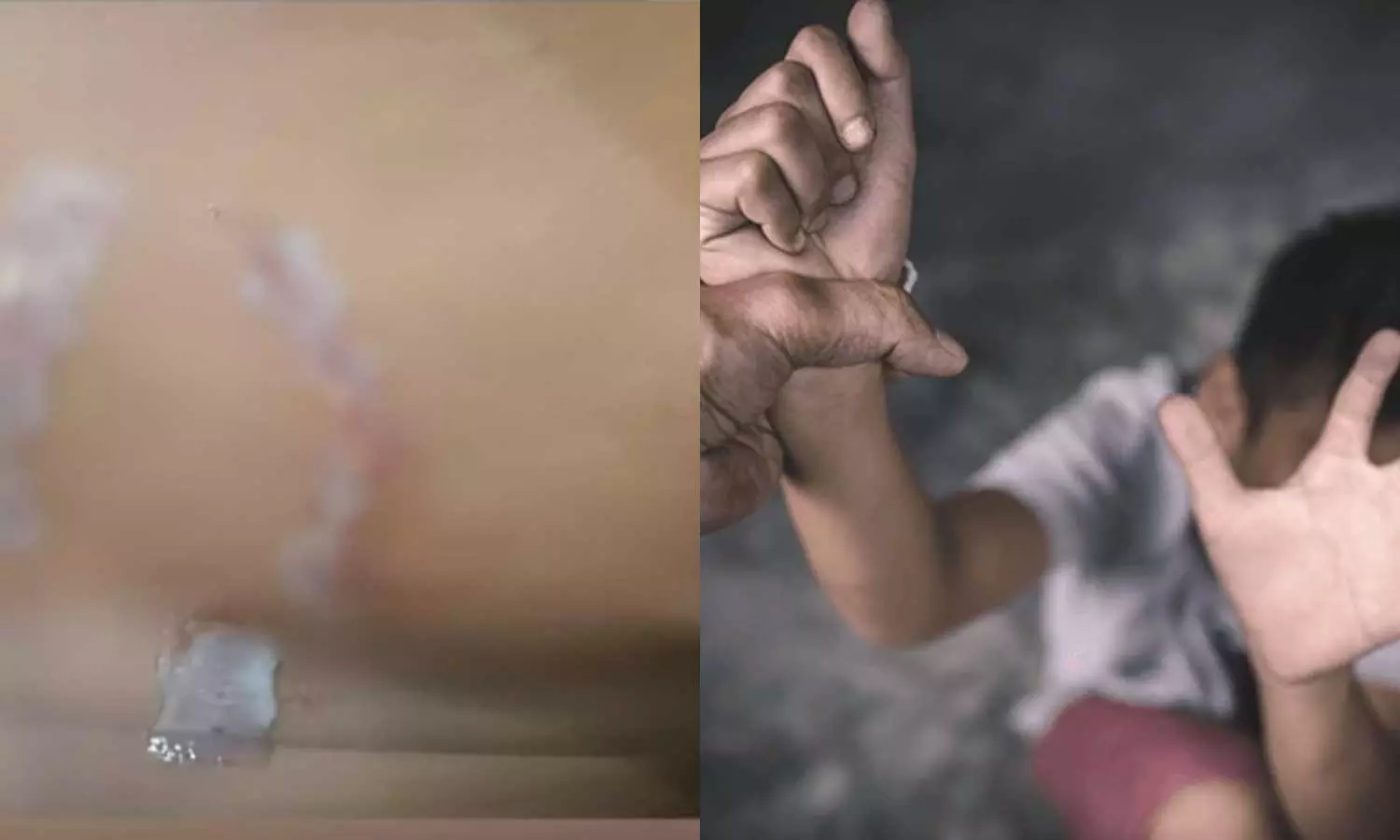 എറണാകുളത്ത് 12കാരനെ ക്രൂരമായി മർദിച്ച സംഭവം: അമ്മയും ആൺസുഹൃത്തും അറസ്റ്റിൽ