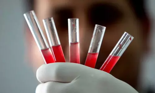 സ്വർണ രക്തമുള്ള ലോകത്തിലെ 50 പേർ; കൂടുതലറിയാം..