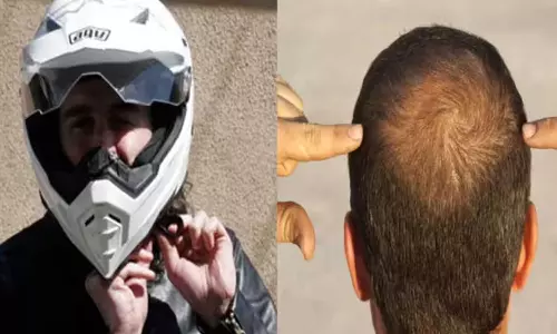 ഹെൽമറ്റ് ധരിക്കുമ്പോൾ മുടികൊഴിച്ചിലുണ്ടോ?; എങ്കിൽ പരിഹാരമുണ്ട്