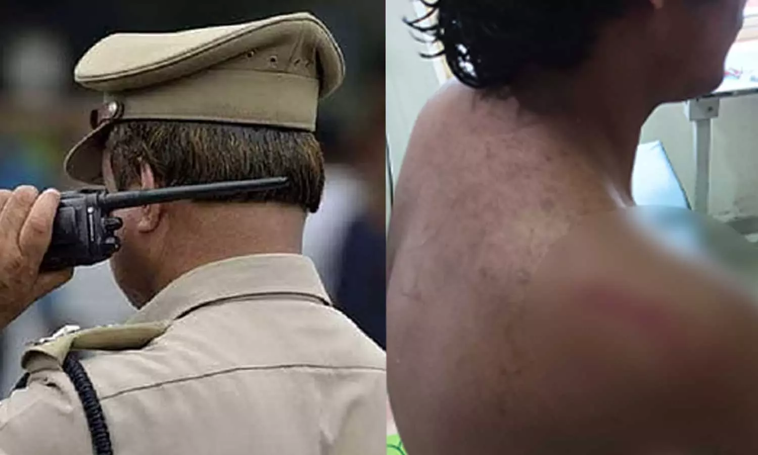 തിരുവനന്തപുരം ആറ്റിങ്ങല്‍ കലോത്സവവേദിയിലുണ്ടായ കയ്യാങ്കളിയിൽ വിദ്യാര്‍ഥിക്ക് ഗുരുതര പരിക്ക്