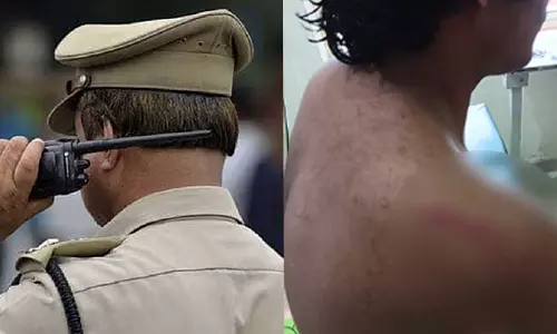 തിരുവനന്തപുരം ആറ്റിങ്ങല്‍ കലോത്സവവേദിയിലുണ്ടായ കയ്യാങ്കളിയിൽ വിദ്യാര്‍ഥിക്ക് ഗുരുതര പരിക്ക്