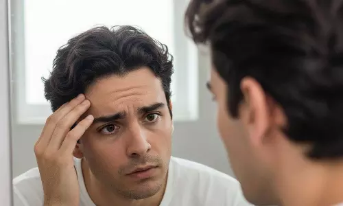 20 വയസാകുമ്പോഴേക്കും മുടി നരക്കുന്നുവോ? കാരണങ്ങളും പരിഹാരങ്ങളും 20 വയസാകുമ്പോഴേക്കും മുടി നരക്കുന്നുവോ? കാരണങ്ങളും പരിഹാരങ്ങളും