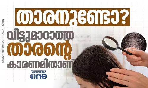 വിട്ടുമാറാത്ത താരന് പിന്നിലെ യഥാർഥ കാരണമറിയാം