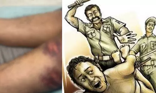 തിരുവനന്തപുരത്ത് യുവാവിനെ പൊലീസ് മർദ്ദിച്ചതായി പരാതി