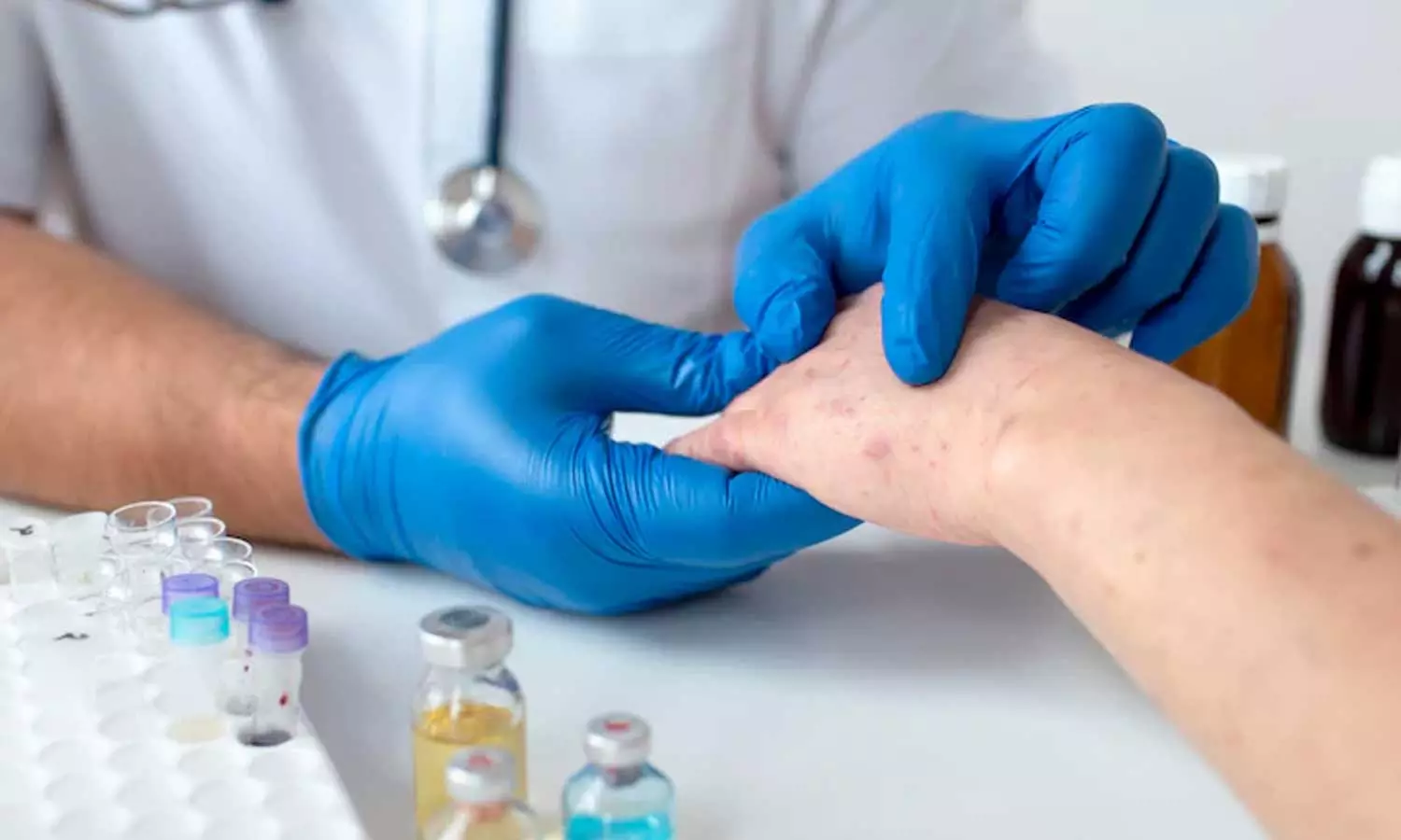 ചർമത്തിലെ അണുബാധ; ഈ ലക്ഷണങ്ങൾ അവഗണിക്കരുത് ചർമത്തിലെ അണുബാധ; ഈ ലക്ഷണങ്ങൾ അവഗണിക്കരുത്